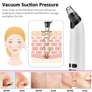 Blackhead Remover Pimple Acne Extractor Face Deep Pore Cleaner Removal Vacuum Suction Acne Black Head Remover Warmer Skin Tools